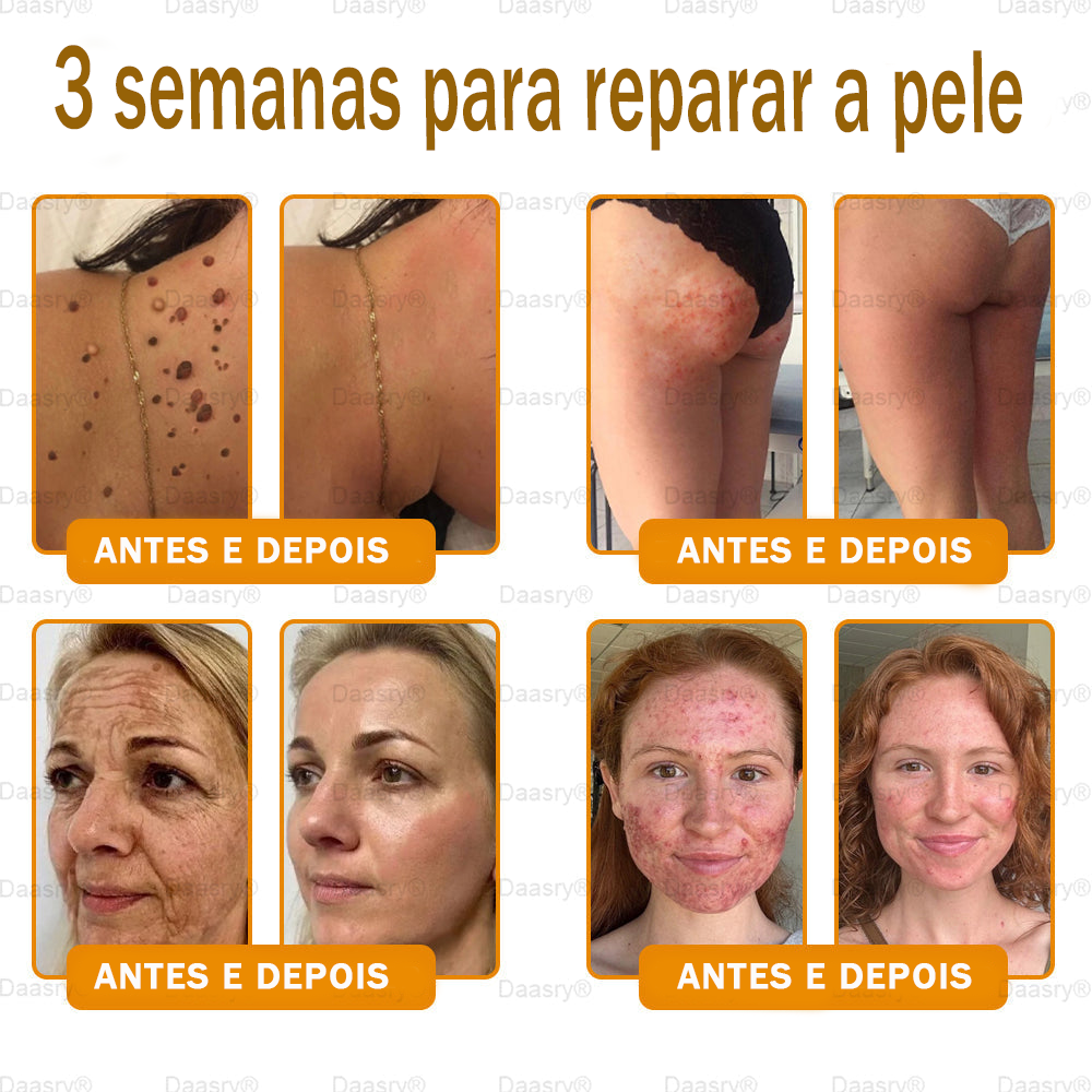 👨‍⚕️Certificado CE: Daasry® Creme Restaurador de Pele com Veneno de Abelha — Efeito Tipo Botox