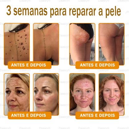 👨‍⚕️Certificado CE: Daasry® Creme Restaurador de Pele com Veneno de Abelha — Efeito Tipo Botox