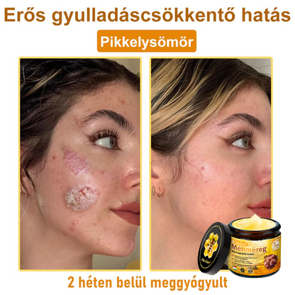 ✨✨ 𝐏𝐮𝐫𝐚𝐂𝐮𝐫𝐞® 𝐌é𝐡𝐦é𝐫𝐞𝐠 𝐁ő𝐫 𝐇𝐞𝐥𝐲𝐫𝐞á𝐥𝐥í𝐭ó 𝐊𝐫é𝐦 (👨‍⚕‍𝐂𝐄 𝐓𝐚𝐧ú𝐬í𝐭𝐯á𝐧𝐲)👍✅