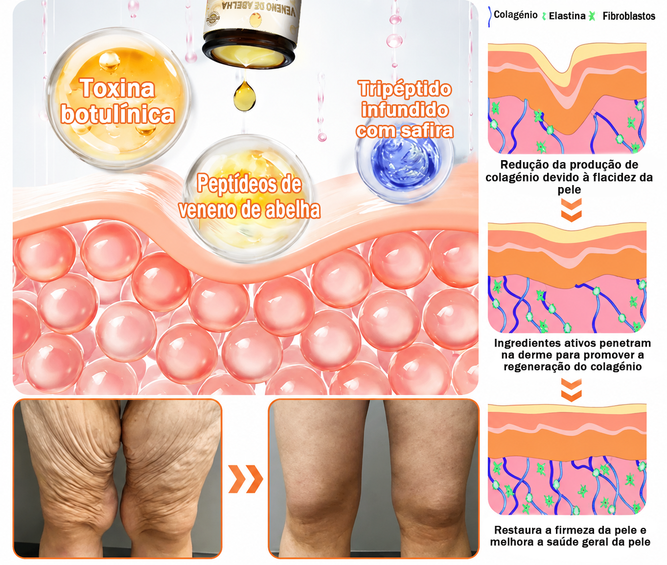 🔥 𝑻𝑳𝑶𝑷𝑨® Creme de Tratamento da Pele com Veneno de Abelha (👨‍⚕️ Com Certificação CE) 👍✅