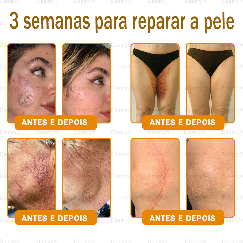 👨‍⚕️Certificado CE: Daasry® Creme Restaurador de Pele com Veneno de Abelha — Efeito Tipo Botox