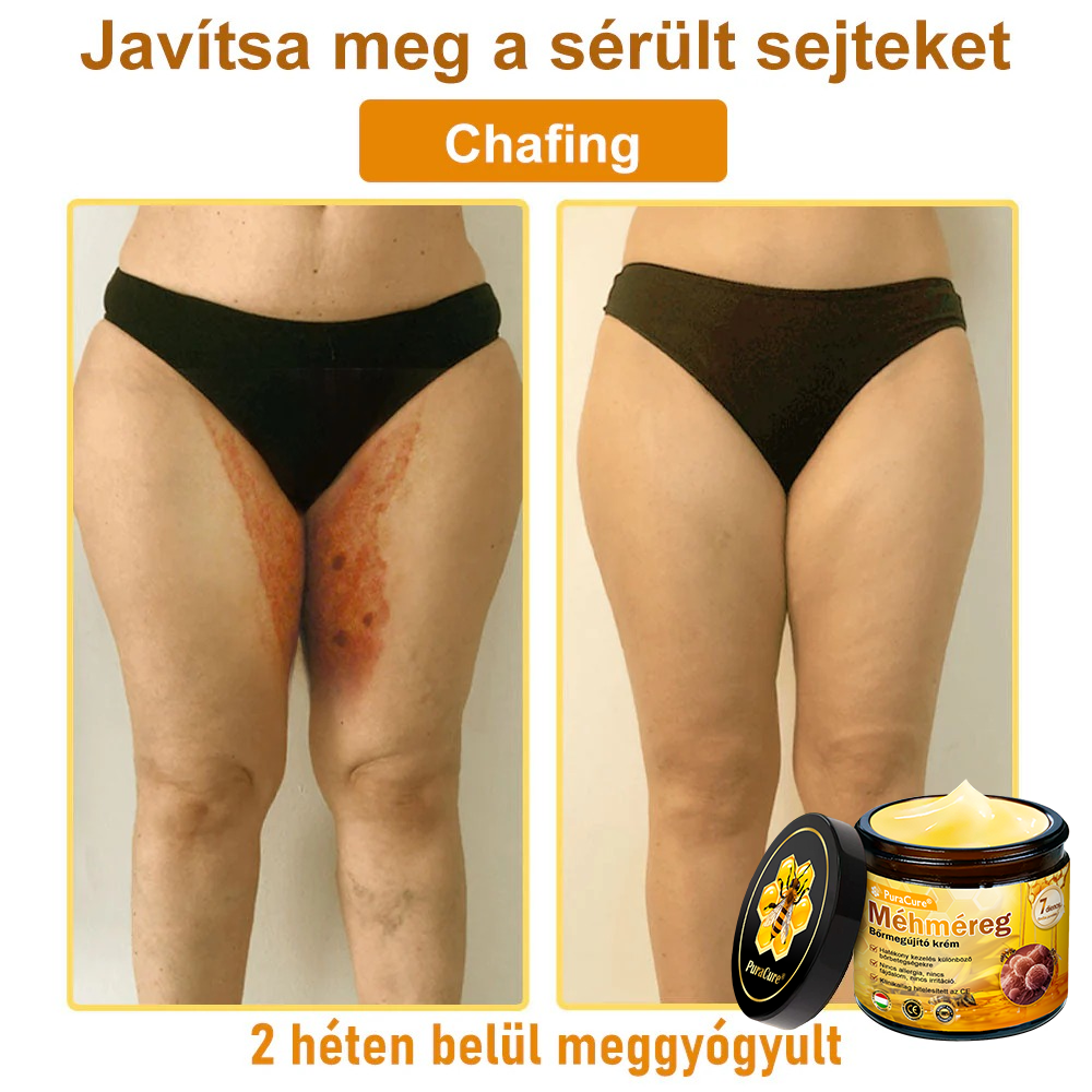 ✨✨ 𝐏𝐮𝐫𝐚𝐂𝐮𝐫𝐞® 𝐌é𝐡𝐦é𝐫𝐞𝐠 𝐁ő𝐫 𝐇𝐞𝐥𝐲𝐫𝐞á𝐥𝐥í𝐭ó 𝐊𝐫é𝐦 (👨‍⚕‍𝐂𝐄 𝐓𝐚𝐧ú𝐬í𝐭𝐯á𝐧𝐲)👍✅