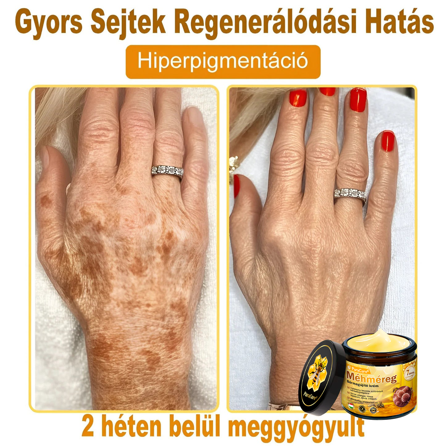 ✨✨ 𝐏𝐮𝐫𝐚𝐂𝐮𝐫𝐞® 𝐌é𝐡𝐦é𝐫𝐞𝐠 𝐁ő𝐫 𝐇𝐞𝐥𝐲𝐫𝐞á𝐥𝐥í𝐭ó 𝐊𝐫é𝐦 (👨‍⚕‍𝐂𝐄 𝐓𝐚𝐧ú𝐬í𝐭𝐯á𝐧𝐲)👍✅