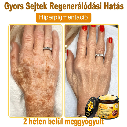 ✨✨ 𝐏𝐮𝐫𝐚𝐂𝐮𝐫𝐞® 𝐌é𝐡𝐦é𝐫𝐞𝐠 𝐁ő𝐫 𝐇𝐞𝐥𝐲𝐫𝐞á𝐥𝐥í𝐭ó 𝐊𝐫é𝐦 (👨‍⚕‍𝐂𝐄 𝐓𝐚𝐧ú𝐬í𝐭𝐯á𝐧𝐲)👍✅