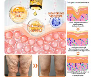 ✨✨ 𝐏𝐮𝐫𝐚𝐂𝐮𝐫𝐞® 𝐌é𝐡𝐦é𝐫𝐞𝐠 𝐁ő𝐫 𝐇𝐞𝐥𝐲𝐫𝐞á𝐥𝐥í𝐭ó 𝐊𝐫é𝐦 (👨‍⚕‍𝐂𝐄 𝐓𝐚𝐧ú𝐬í𝐭𝐯á𝐧𝐲)👍✅