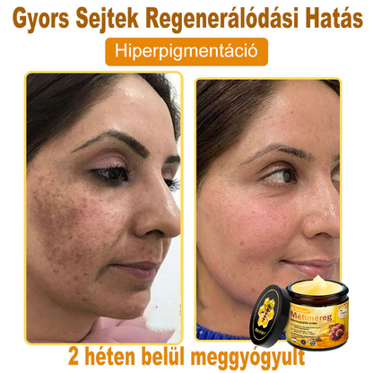 ✨✨ 𝐏𝐮𝐫𝐚𝐂𝐮𝐫𝐞® 𝐌é𝐡𝐦é𝐫𝐞𝐠 𝐁ő𝐫 𝐇𝐞𝐥𝐲𝐫𝐞á𝐥𝐥í𝐭ó 𝐊𝐫é𝐦 (👨‍⚕‍𝐂𝐄 𝐓𝐚𝐧ú𝐬í𝐭𝐯á𝐧𝐲)👍✅