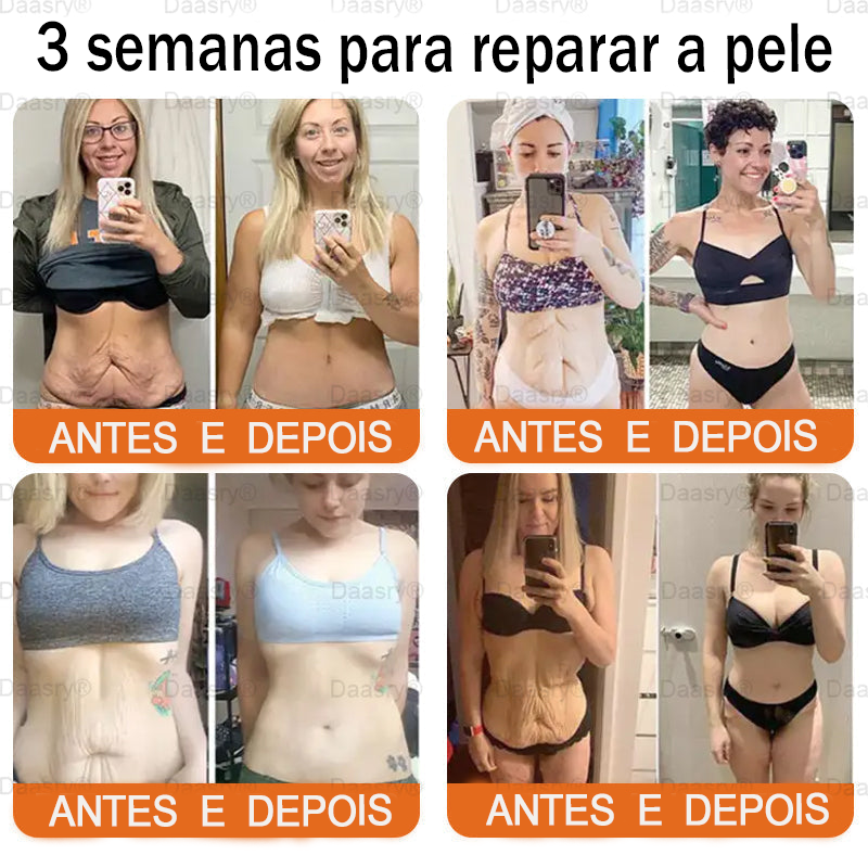 👨‍⚕️Certificado CE: Daasry® Creme Restaurador de Pele com Veneno de Abelha — Efeito Tipo Botox