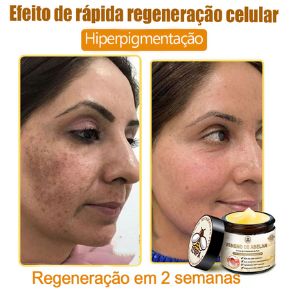 🔥 𝑻𝑳𝑶𝑷𝑨® Creme de Tratamento da Pele com Veneno de Abelha (👨‍⚕️ Com Certificação CE) 👍✅