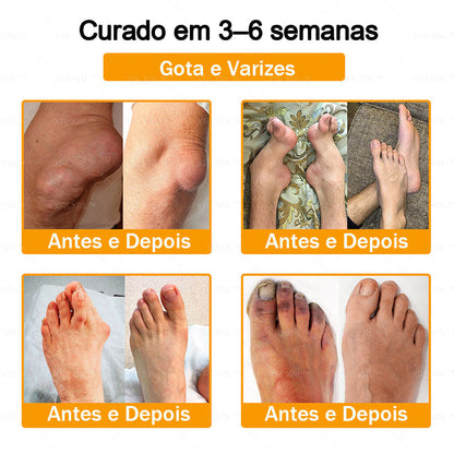 XRLXRL® Creme Reparador Ósseo e Alívio da Dor com Veneno de Abelha (Especialmente desenvolvido para pessoas idosas)