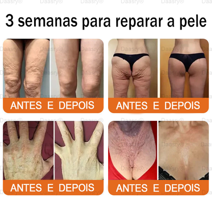 👨‍⚕️Certificado CE: Daasry® Creme Restaurador de Pele com Veneno de Abelha — Efeito Tipo Botox