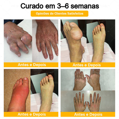 XRLXRL® Creme Reparador Ósseo e Alívio da Dor com Veneno de Abelha (Especialmente desenvolvido para pessoas idosas)