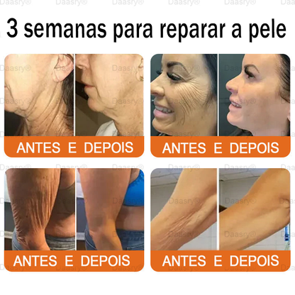 👨‍⚕️Certificado CE: Daasry® Creme Restaurador de Pele com Veneno de Abelha — Efeito Tipo Botox