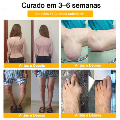 XRLXRL® Creme Reparador Ósseo e Alívio da Dor com Veneno de Abelha (Especialmente desenvolvido para pessoas idosas)