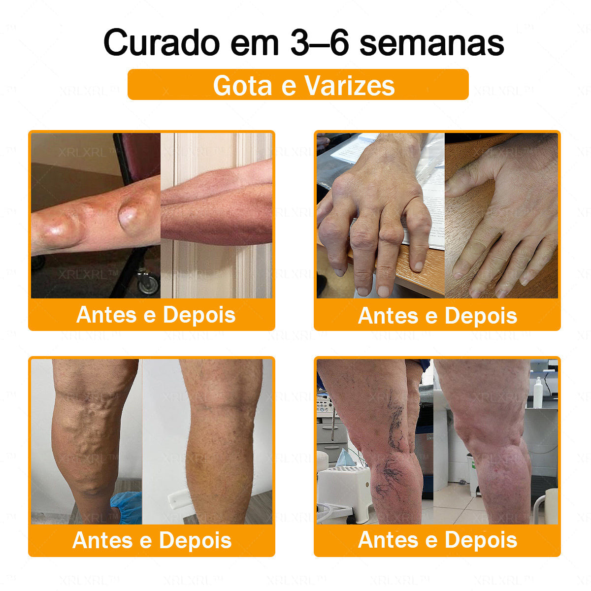 XRLXRL® Creme Reparador Ósseo e Alívio da Dor com Veneno de Abelha (Especialmente desenvolvido para pessoas idosas)