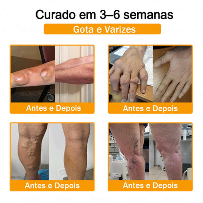 XRLXRL® Creme Reparador Ósseo e Alívio da Dor com Veneno de Abelha (Especialmente desenvolvido para pessoas idosas)