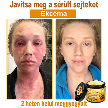 ✨✨ 𝐏𝐮𝐫𝐚𝐂𝐮𝐫𝐞® 𝐌é𝐡𝐦é𝐫𝐞𝐠 𝐁ő𝐫 𝐇𝐞𝐥𝐲𝐫𝐞á𝐥𝐥í𝐭ó 𝐊𝐫é𝐦 (👨‍⚕‍𝐂𝐄 𝐓𝐚𝐧ú𝐬í𝐭𝐯á𝐧𝐲)👍✅