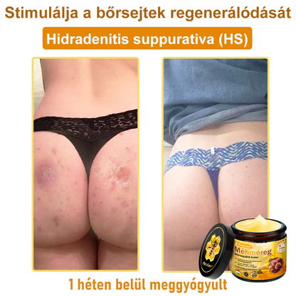 ✨✨ 𝐏𝐮𝐫𝐚𝐂𝐮𝐫𝐞® 𝐌é𝐡𝐦é𝐫𝐞𝐠 𝐁ő𝐫 𝐇𝐞𝐥𝐲𝐫𝐞á𝐥𝐥í𝐭ó 𝐊𝐫é𝐦 (👨‍⚕‍𝐂𝐄 𝐓𝐚𝐧ú𝐬í𝐭𝐯á𝐧𝐲)👍✅