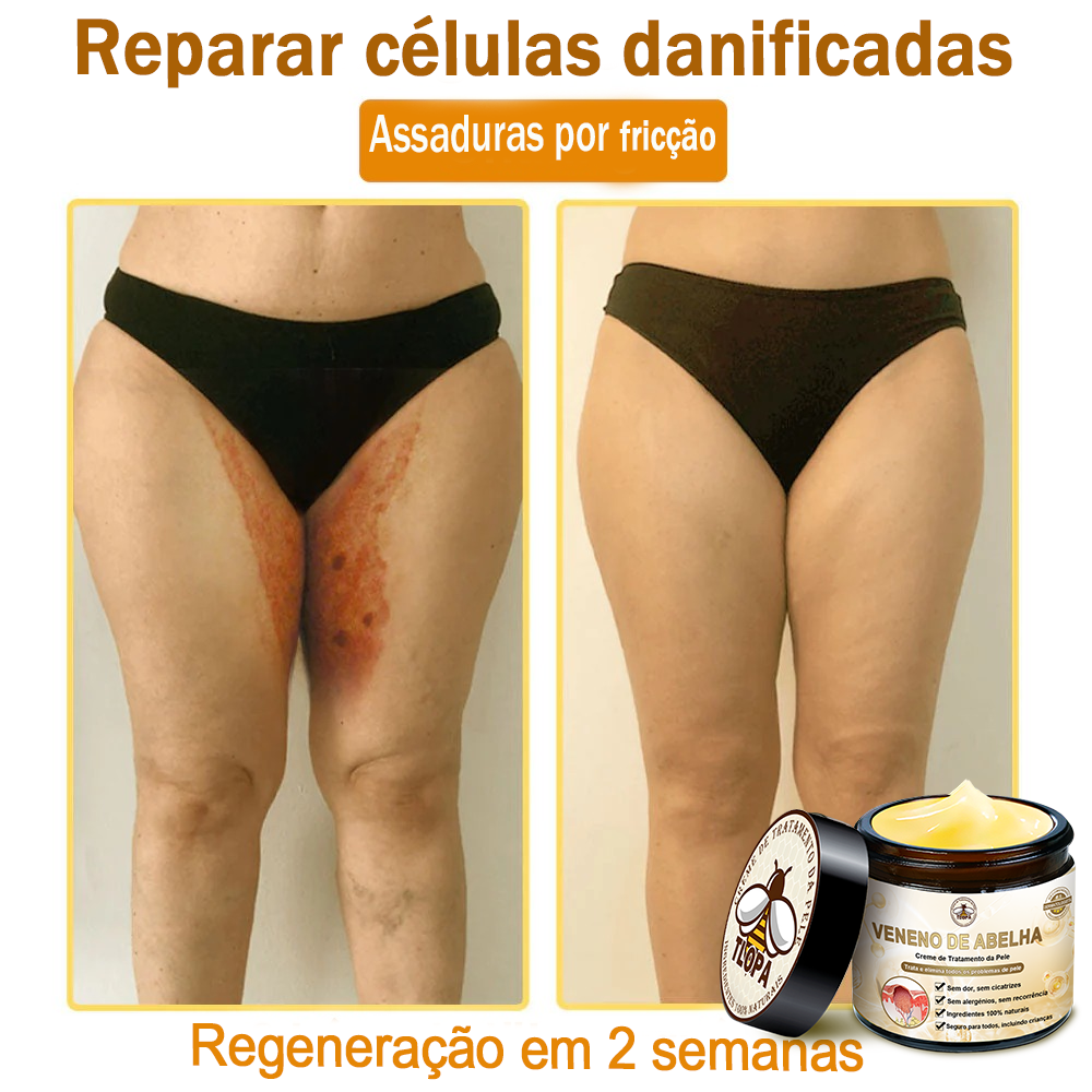🔥 𝑻𝑳𝑶𝑷𝑨® Creme de Tratamento da Pele com Veneno de Abelha (👨‍⚕️ Com Certificação CE) 👍✅