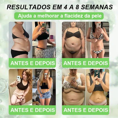 🌿 Novo e Atualizado em 2026 | 👨‍⚕️ 𝑫𝑶𝑻𝑨𝑳𝑬® 𝑴𝒐𝒓𝒊𝒏𝒈𝒂 · 𝑩𝒆𝒓𝒃𝒆𝒓𝒊𝒏𝒂 × 𝑵𝑨𝑫+ 𝑨𝒅𝒆𝒔𝒊𝒗𝒐 𝑨𝒗𝒂𝒏ç𝒂𝒅𝒐 𝑵𝒂𝒏𝒐 𝑴𝒊𝒄𝒓𝒐𝒏𝒆𝒆𝒅𝒍𝒆 10 𝒆𝒎 1✅ Ajuda a combater a obesidade, a flacidez da pele, a diabetes, a apneia do sono, os problemas nas articulações e muito mais